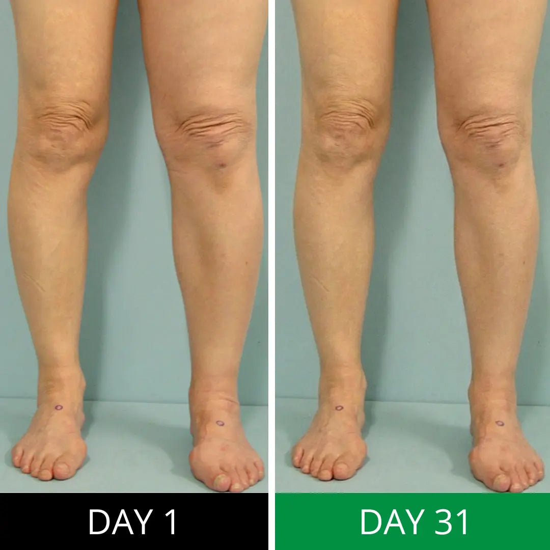 Nature's Flow Lymphatic Cream